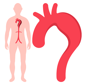 Mercado de injertos de stent vascular torácico